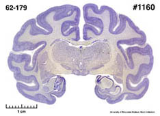 Brain section image